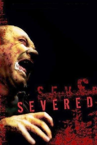 Severed - Forest of the Dead