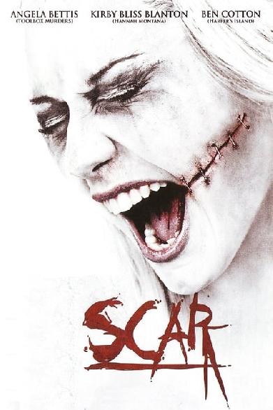 Scar